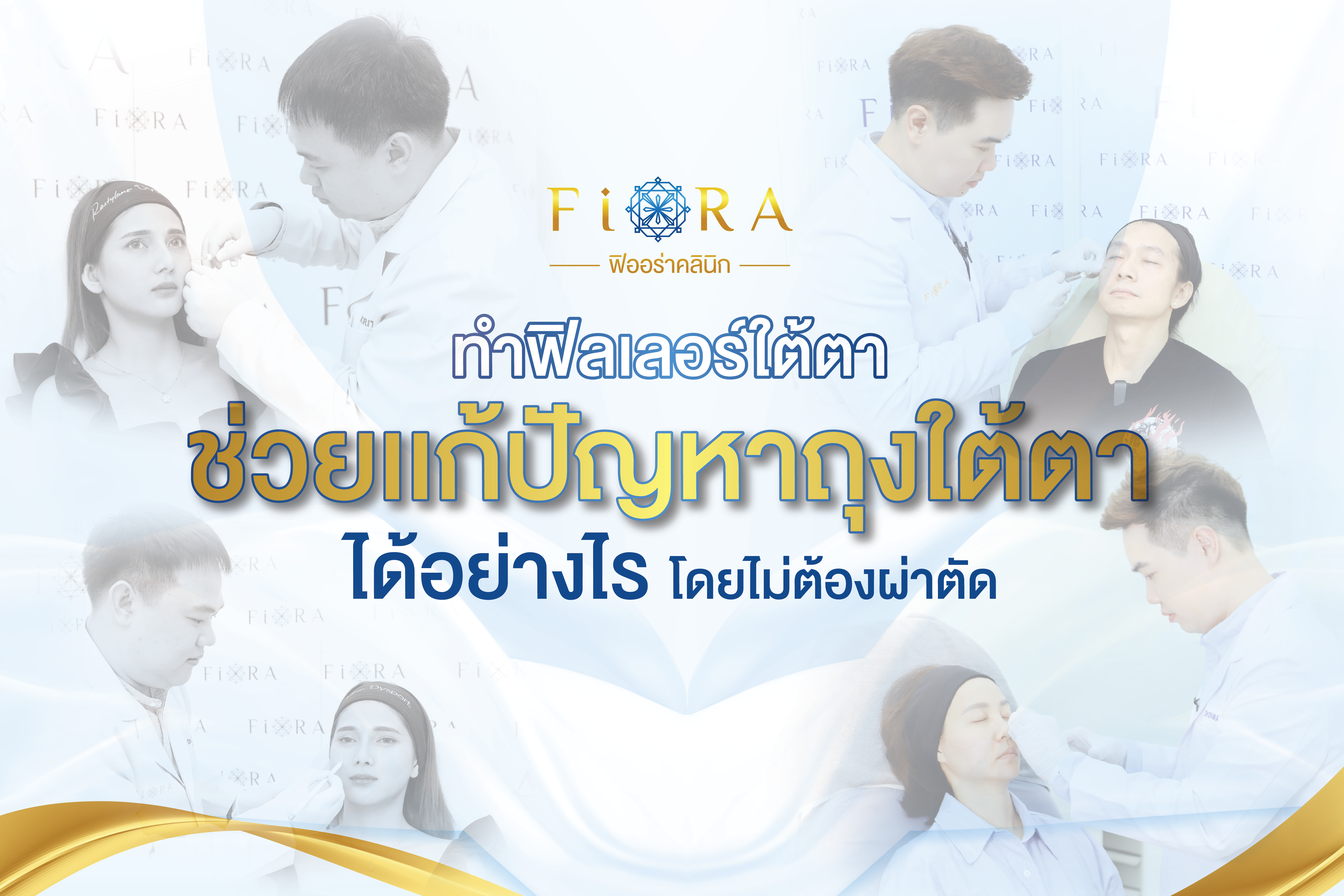 ฟิลเลอร์ใต้ตา