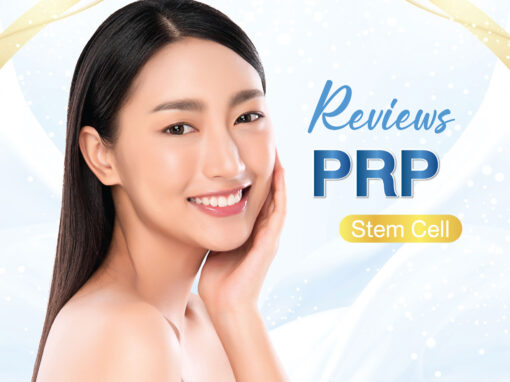 PRP Stem Cell