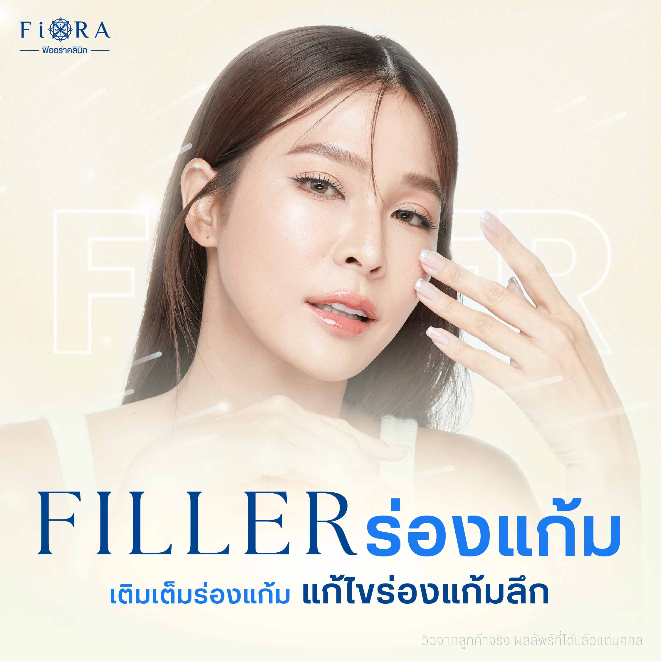 Filler ร่องแก้ม หรือฟิลเลอร์ร่องแก้ม โดยคุณหมอเพชร แพทย์ผู้สอนแพทย์ฉีดฟิลเลอร์ระดับนานาชาติ พร้อมทีมแพทย์มากประสบการณ์