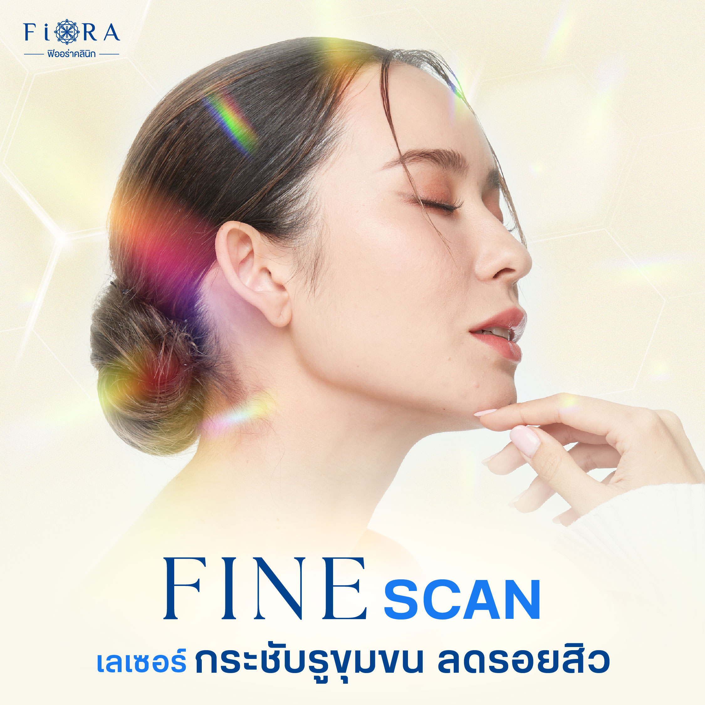 ฟิออร่าคลินิก รักษารอยสิว หลุมสิวด้วย Fine Scan เป็นเลเซอร์ที่ช่วยรักษารอยหลุมสิวขนาดใหญ่และลึกให้ตื้นขึ้น ช่วยฟื้นฟูผิวโดยกระตุ้นให้เกิดการสร้างคอลลาเจน รูขุมขนเล็กลง ผิวอิ่มฟู