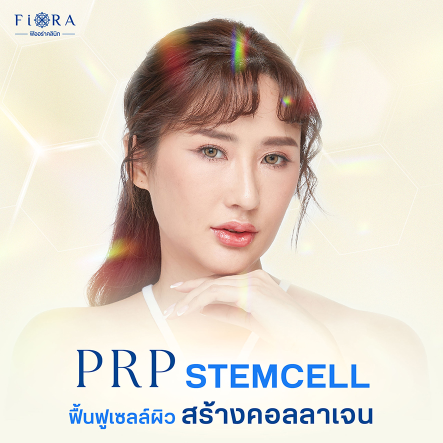 ฟิออร่าคลินิก มีPRP Stem Cell ฟื้นฟูเซลล์ผิวด้วยเกล็ดเลือดตัวเอง ช่วยลดเลือนฝ้า กระ จุดด่างดำ หน้าสว่างกระจ่างใส