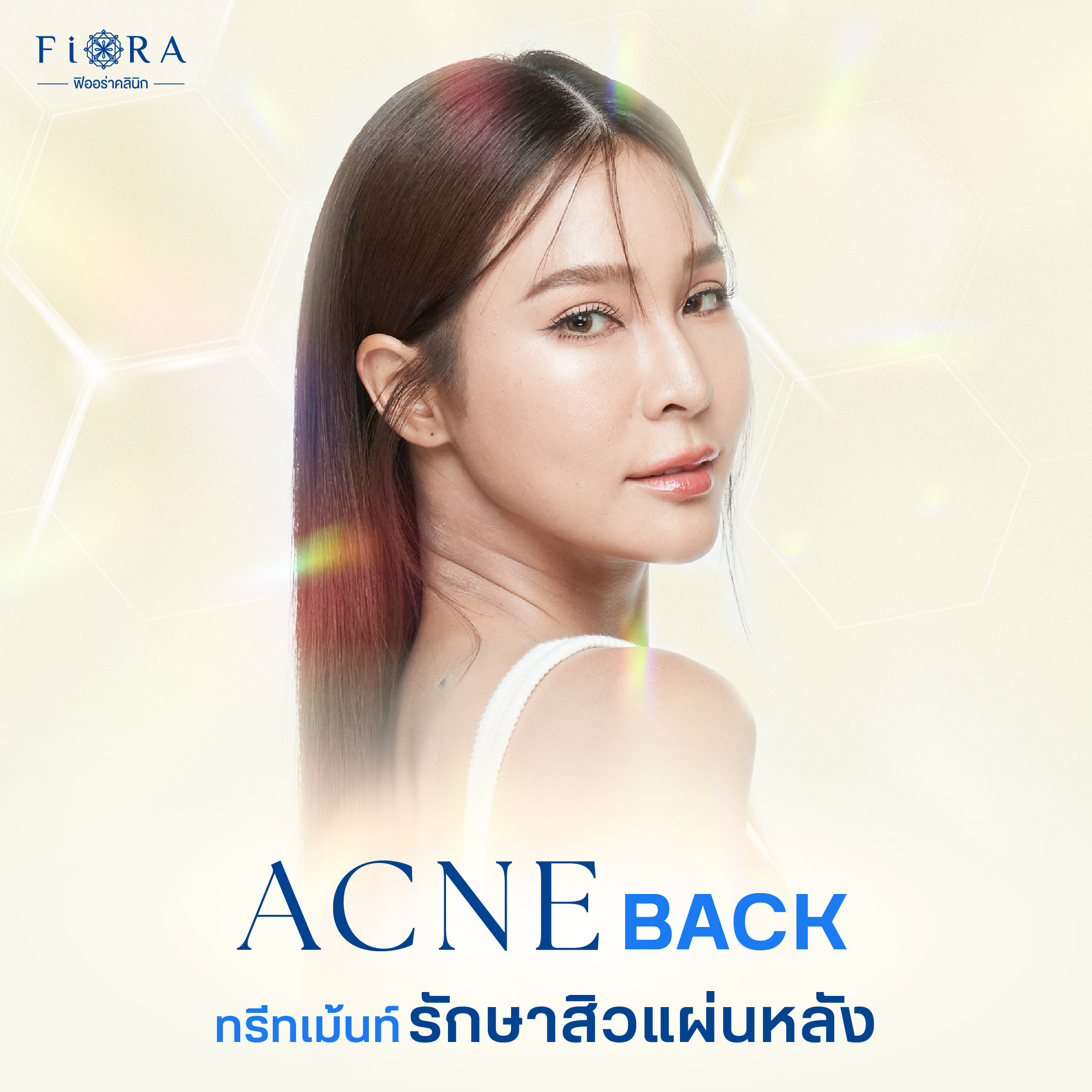 ฟิออร่าคลินิกมี โปรแกรม Acne Back เป็นโปรแกรมทรีทเม้นท์รักษาสิวที่แผ่นหลัง 4 ขั้นตอน ที่คิดค้นเฉพาะสำหรับฟิออร่าคลินิก