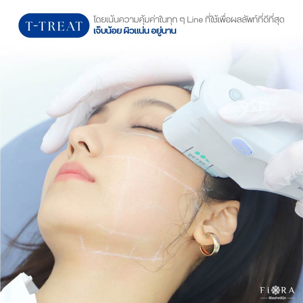 นิยามของ T = Treat ใน Ulthera SPT คือ รักษา