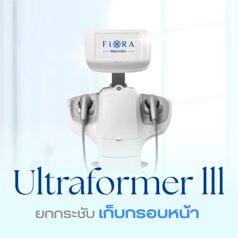 Ultraformer III