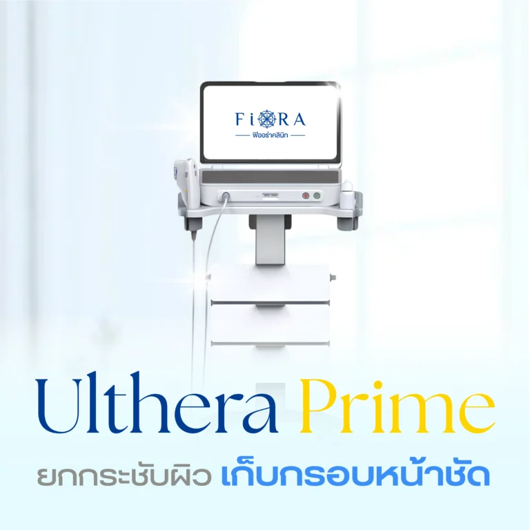 Ulhera Prime