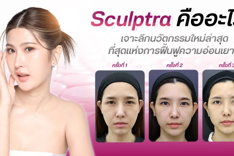 Sculptra คืออะไร
