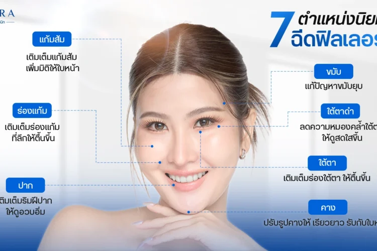 ภาพแสดงบริเวณที่ฉีด Filler